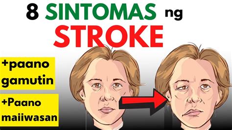 Stroke Signs and Symptoms in Tagalog (Filipino).